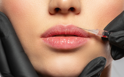 Botox na Medicina Dentária